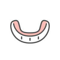 マウスピース矯正